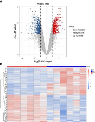 Bioinformatics analysis identifies potential ferroptosis key genes in the pathogenesis of diabetic peripheral neuropathy